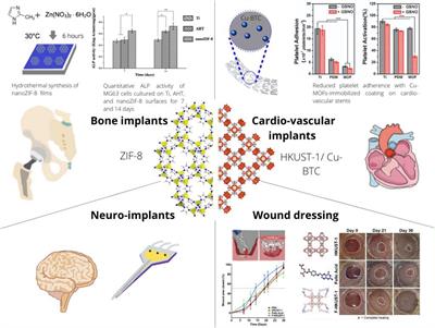 Metal-Organic Framework (MOF)-Based Biomaterials for Tissue Engineering and Regenerative Medicine